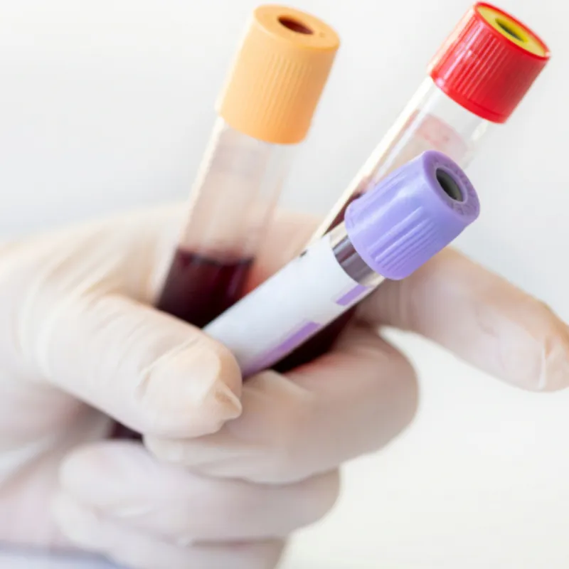 Blood Test BLOOD TESTs