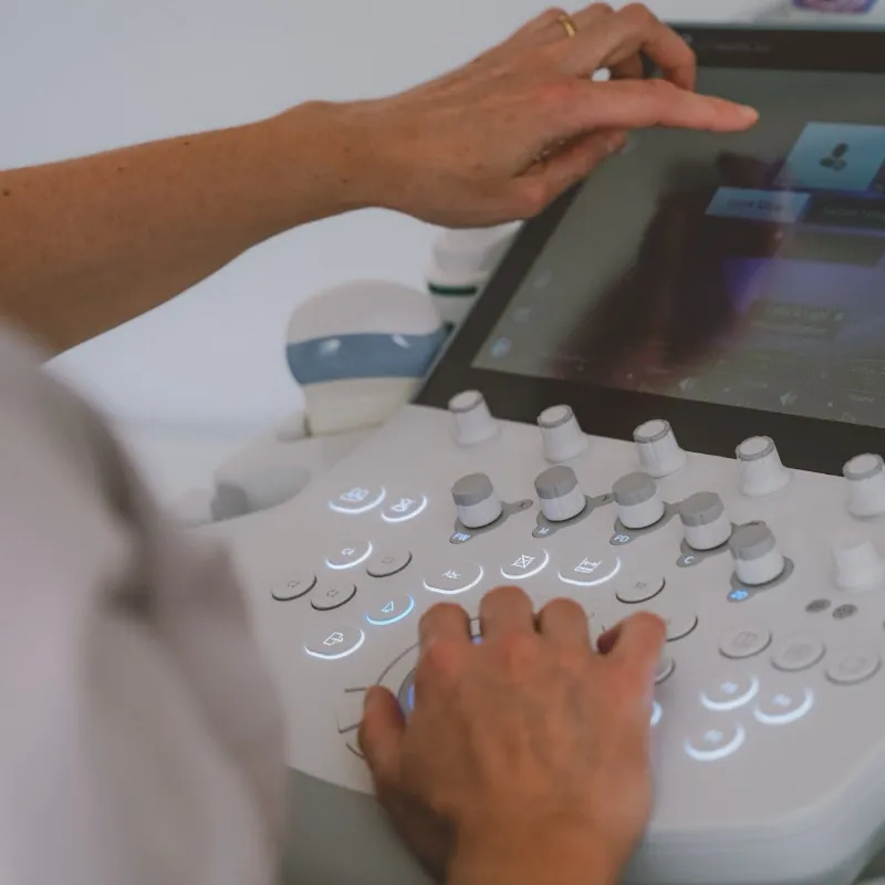 Ultrasound Scan ULTRASOUND SCAN